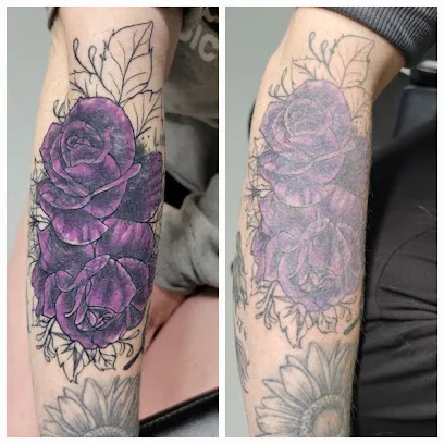 Black Out Tattoo Removal