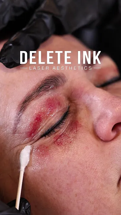 Delete Ink Laser Aesthetics