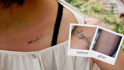 EradiTatt Tattoo Removal of St. Petersburg