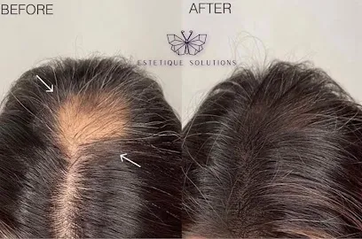 Estetique Solutions