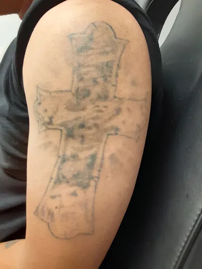 Fearless Tattoo Removal