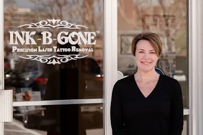 INK B GONE Tattoo Removal Denver