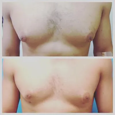 la Piel Perfecta Laser Center