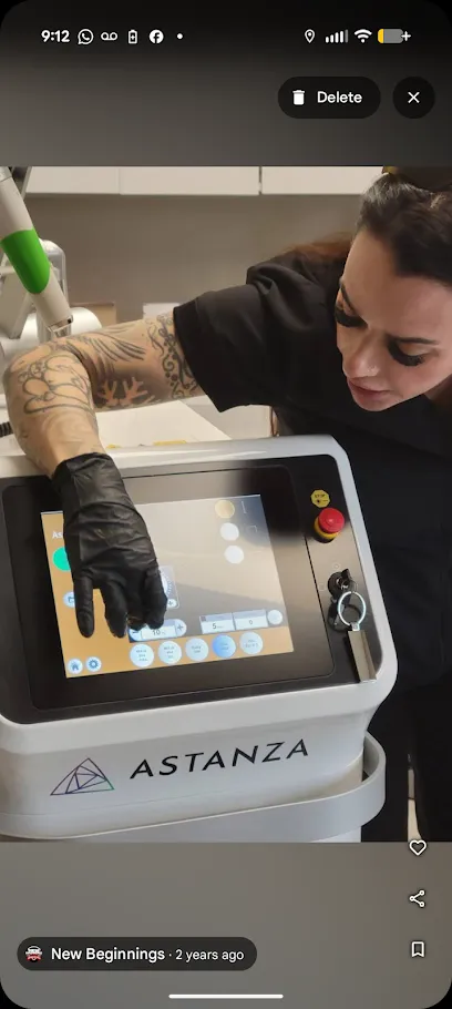New Beginnings Tattoo Removal