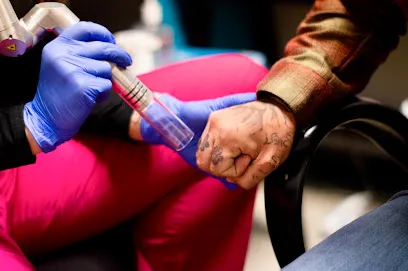 New Skin Tattoo Removal