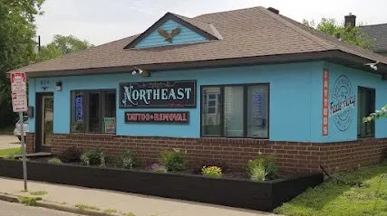 Northeast Tattoo & Fadeaway Laser Tattoo Removal