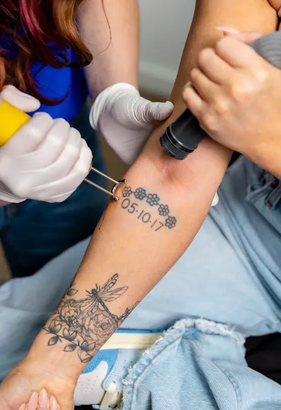 Restore Tattoo Removal