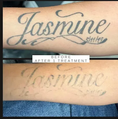 San Antonio Tattoo Removal Co.