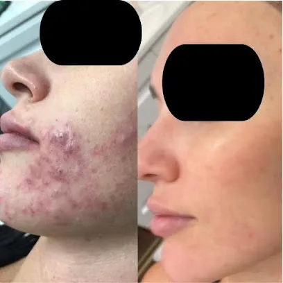 Silk Skin Laser Spa