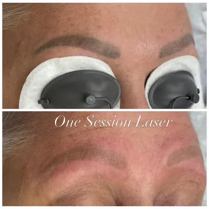 Utah Laser PMU & Tattoo Removal