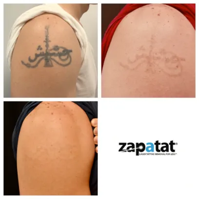 Zapatat